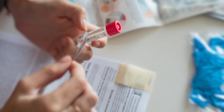 Delta Is Now Selling Packable COVID Tests for Return Flights to the U.S.